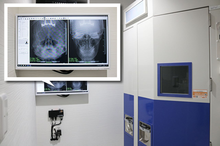 コーンビームCT