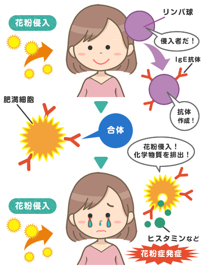 アレルギー性鼻炎