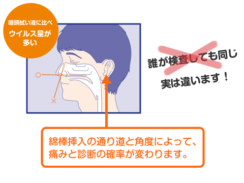 インフルエンザ